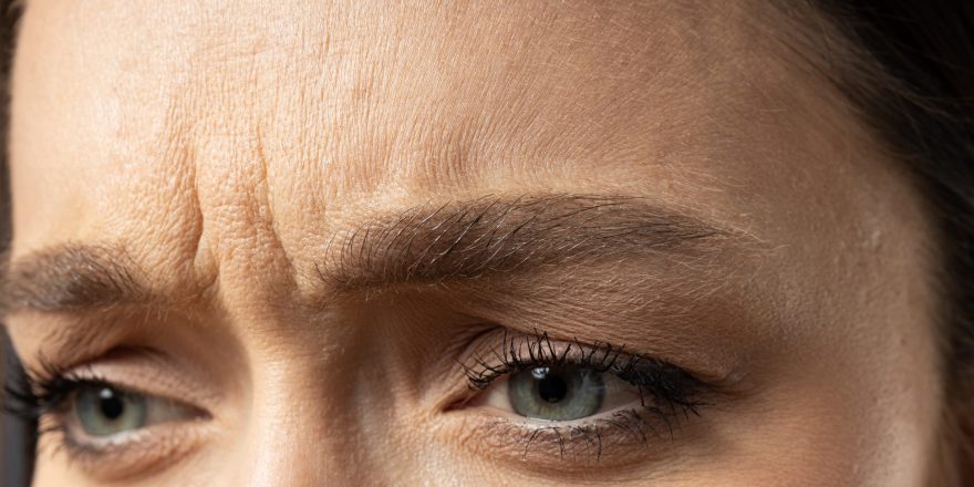 anti wrinkle crows feet forhead forwn