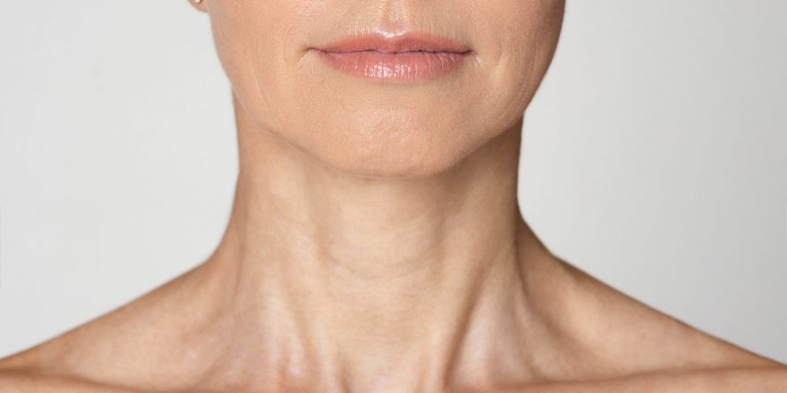 Neck and Platysma Bands