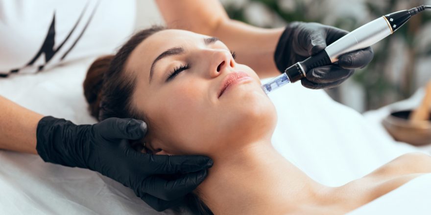 microneedling